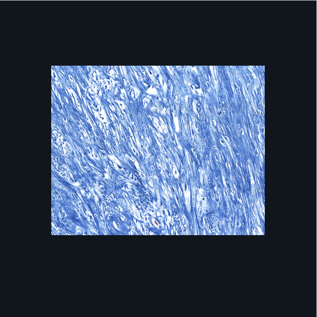 <p>What type of cartilage is in the image? Where is this specific type of cartilage found?</p>