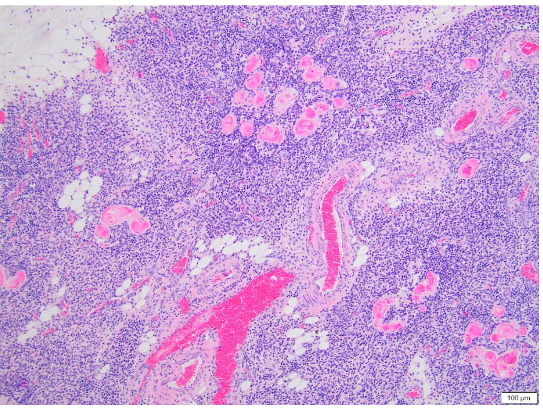 <p>is this normal thymus?</p>