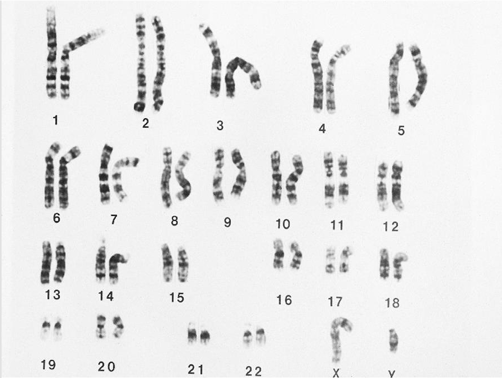 <p>What is this image? </p>