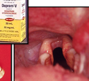 <p>Laryngeal Paralysis (LARPAR)</p>