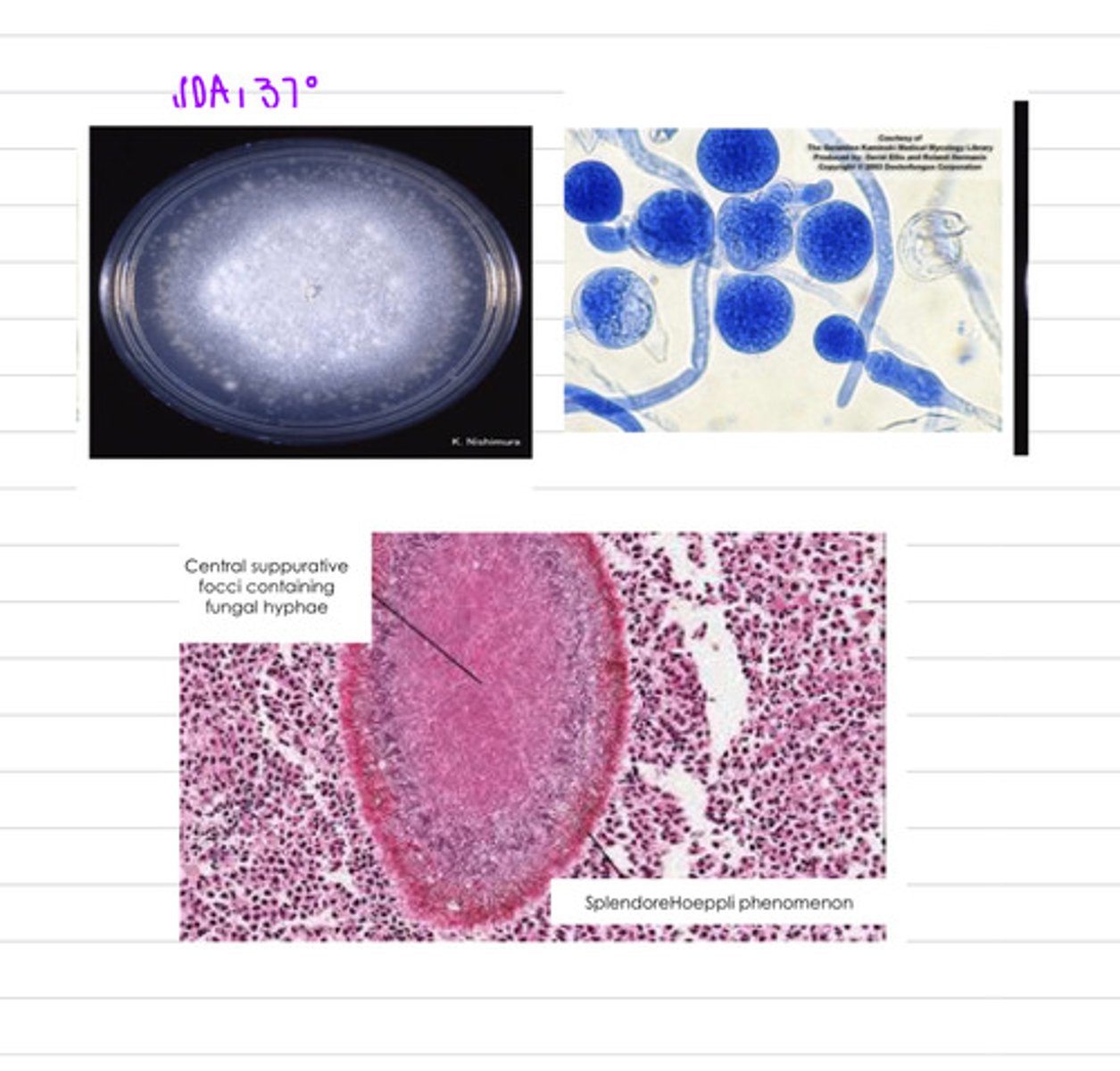 <p>a dog is showing subcutaneous, GI, and pulmonary granulomas, so we take a biopsy and grow the samples on SDA at 37 degrees. we also directly view a sample under a microscope. we find these results.</p><p>what is the diagnosis?</p>