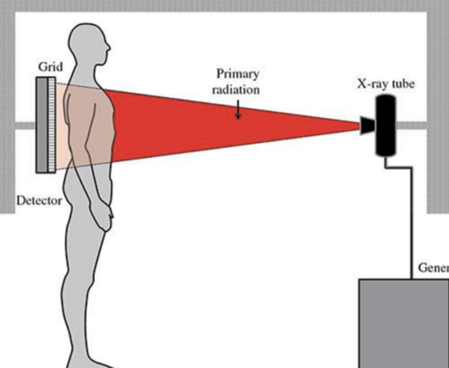 <p>Defined as the path of the Central ray as it exits the xray tube, passing through the patient to the IR</p><p>identified by the entrance and exits points of the body</p>