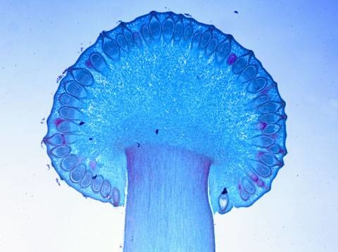 rye ergot (asci w ascospores)
Ascomycota 