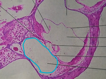 This structure is FILLED with