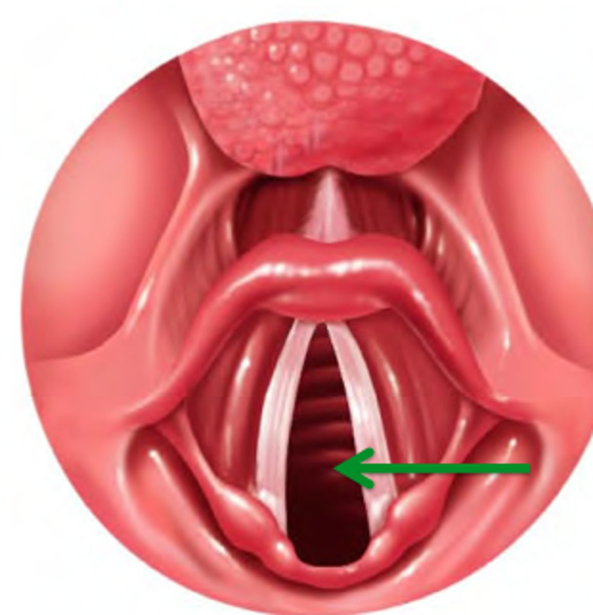 <p>14. The opening between the vocal cords in the larynx.</p>