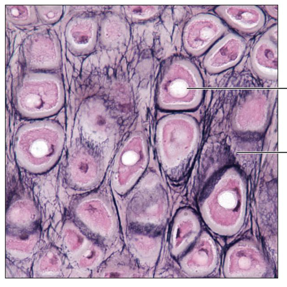 <p>What is this tissue, and where is it found?</p>