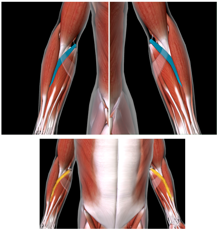 <p><strong>Function: PRONATE FOREARM </strong></p><ul><li><p><strong>MEDIAL TO BRACHIORADIALIS</strong></p></li><li><p><strong>In the ANTEBRACHIAL area </strong></p></li></ul><p></p>