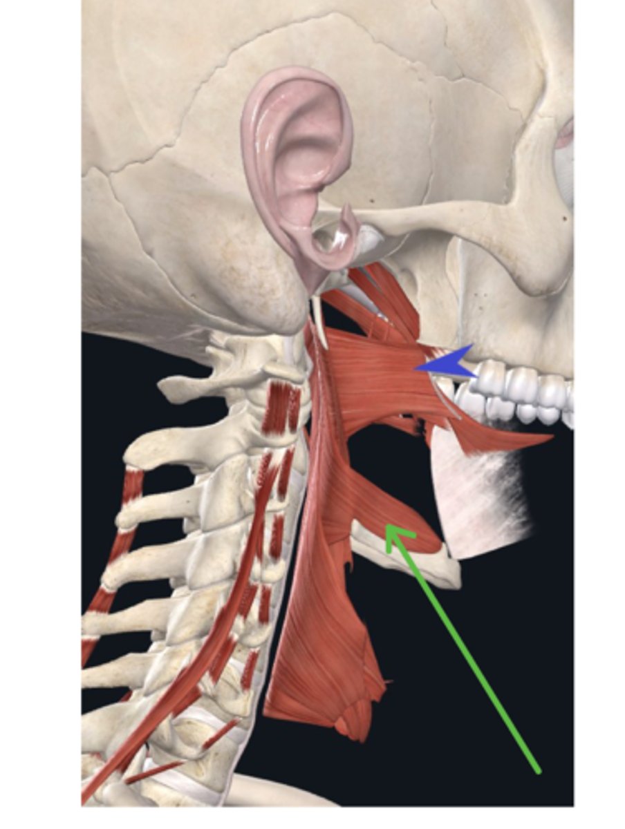 <p>What is the muscle the green arrow is pointing to?</p>