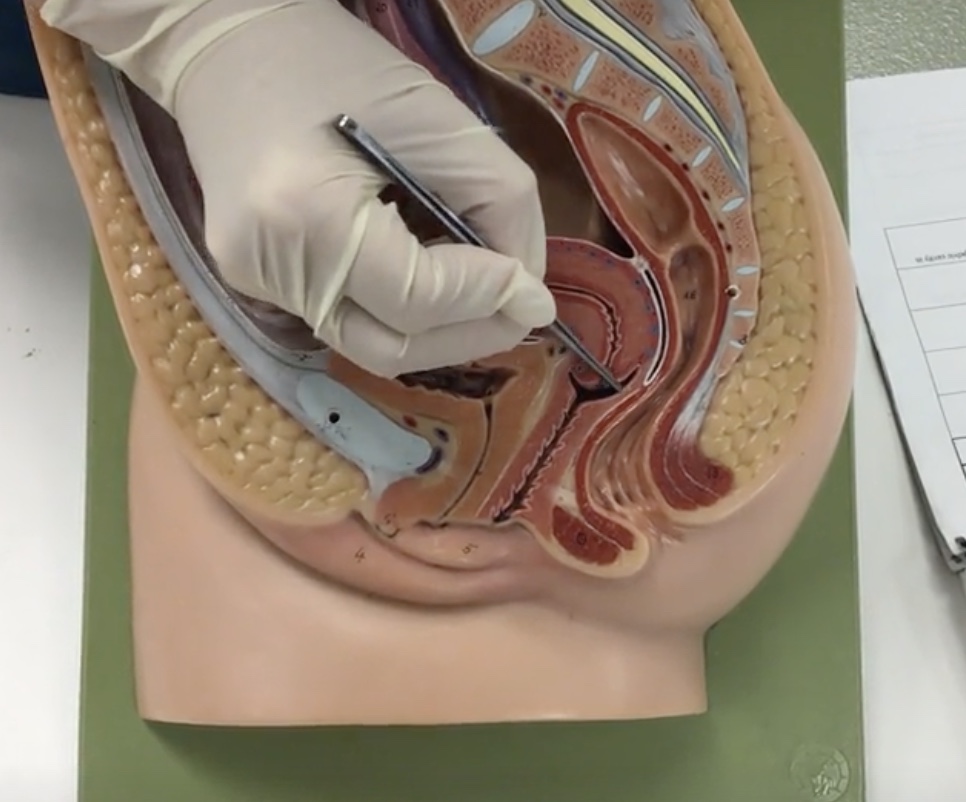 <p>Description: Cylindrical end of the uterus</p><p>Relationship: N/A</p>