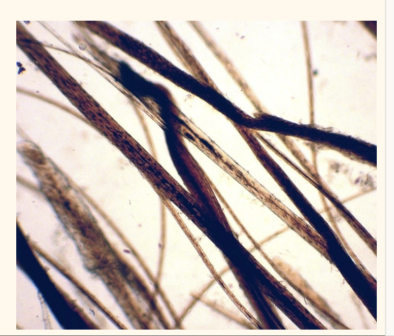 <p>a hair pluck from balding dog</p>