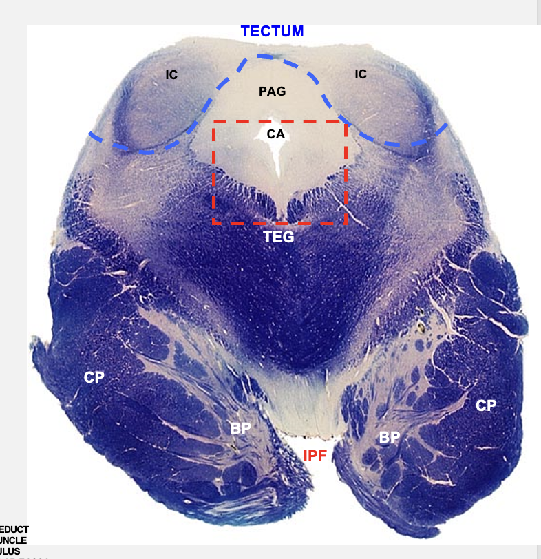 <p>caudal midbrain cross section structures </p>