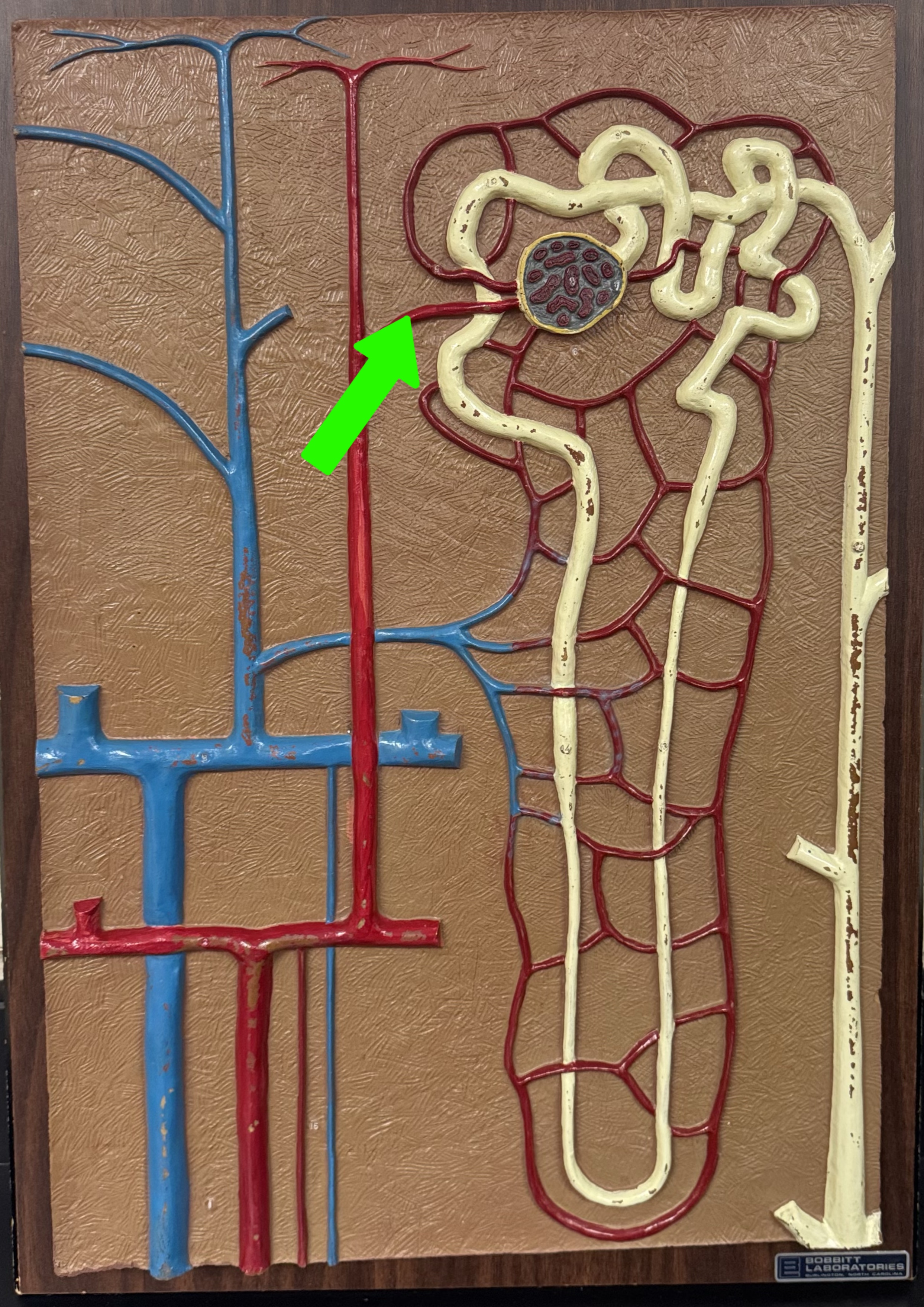 <p>What are these parts of the nephron?</p>