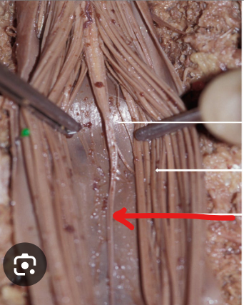 <p><span>thin, fibrous cord that extends from the conus medullaris to the coccyx.&nbsp;</span></p>