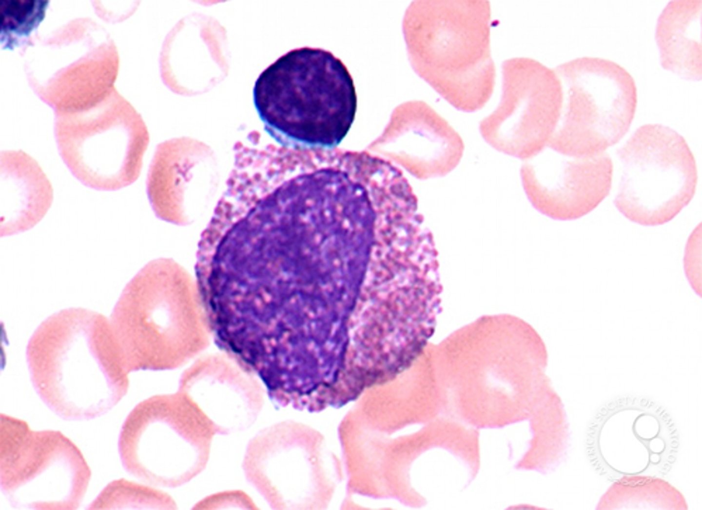<p>N:C ratio is low, meaning there is more cytoplasm relative to the nucleus.</p>