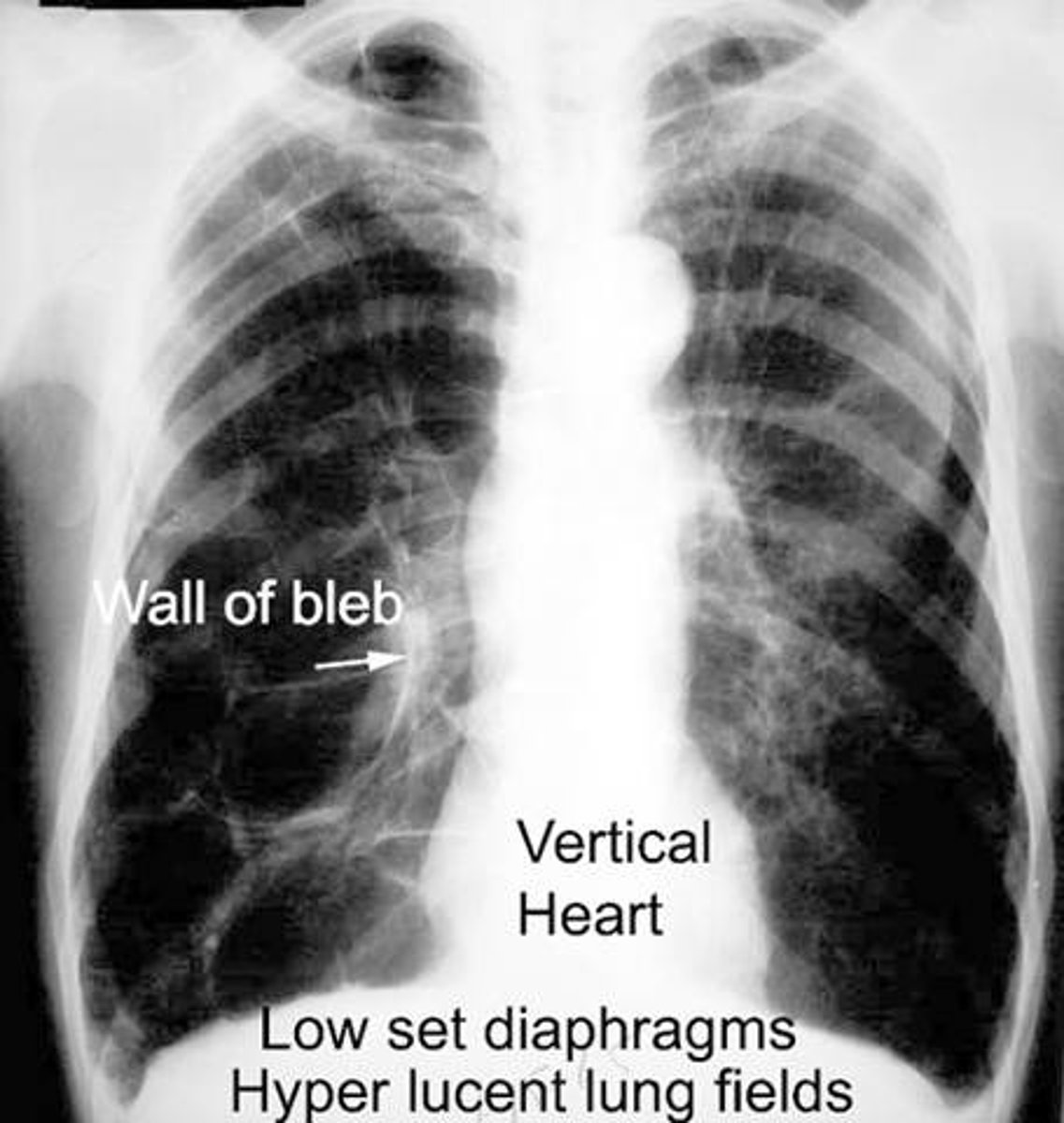 <p>film based or digitally produced recording of anatomic structures</p>