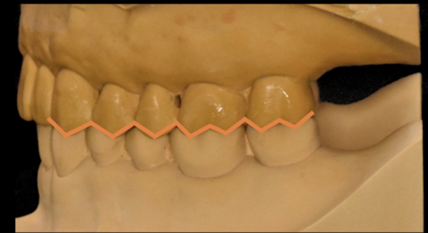 <p>condylar position</p>