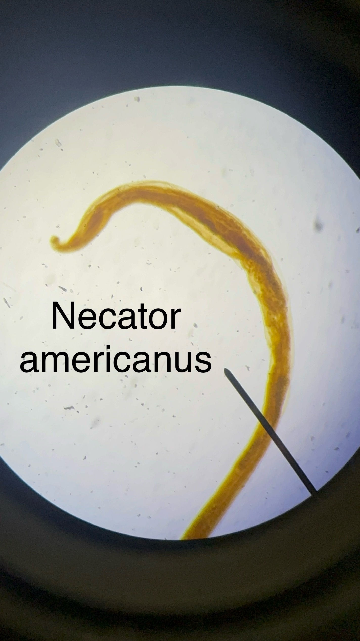 <p>Domain: Eukarya</p><p style="text-align: start">Kingdom: Animalia</p><p style="text-align: start">Phylum: Nematoda</p><p style="text-align: start">Genus: Necator</p><p style="text-align: start">Species: americanus</p><p style="text-align: start">Causes “Hookworm” disease</p><p style="text-align: start"></p><ul><li><p style="text-align: start">Adult lives in small intestine</p></li><li><p style="text-align: start">Infectious larvae burrows in skin</p></li></ul>