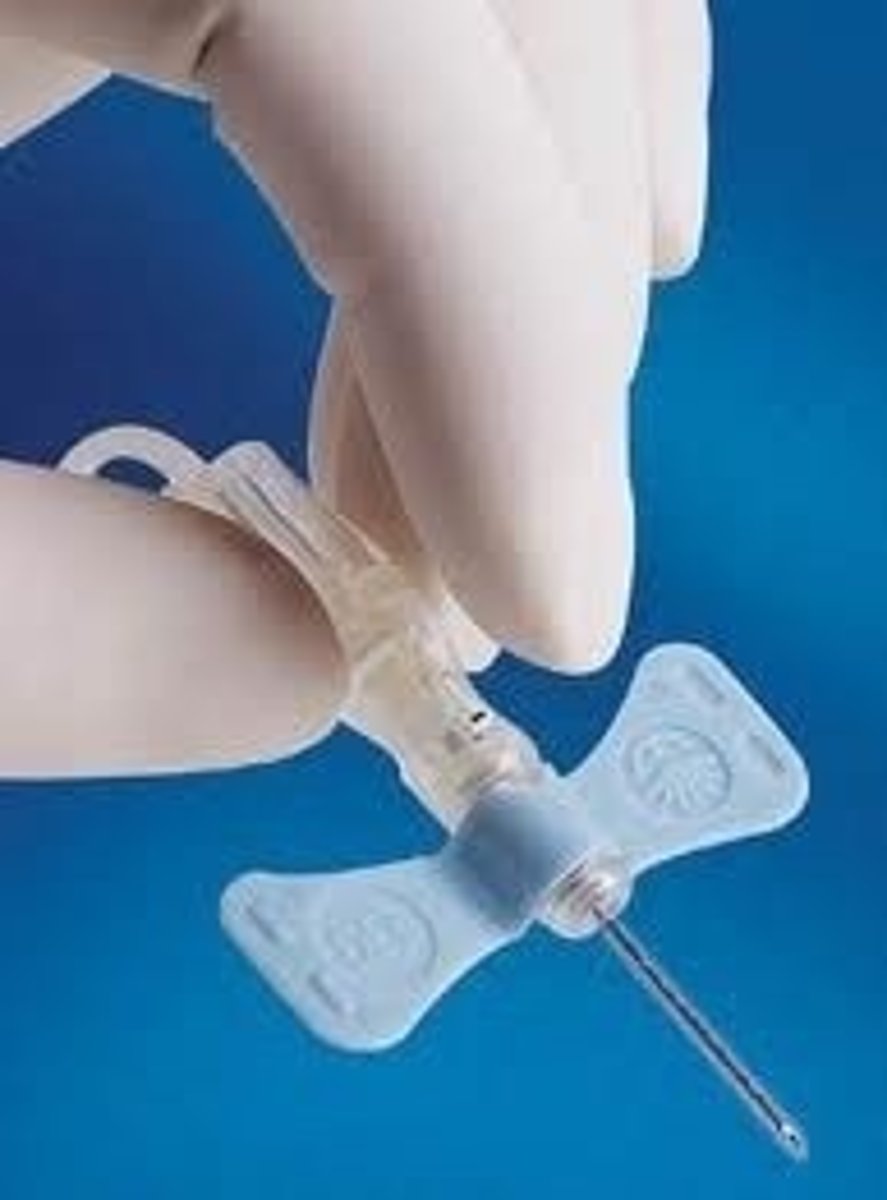 <p>D. CORRECT. For better control and less pressure, the medical assistant should use the butterfly needle method for an older adult patient who has small veins.</p><p>A. A finger puncture is a form of capillary puncture. It is performed when the test requires a very small sample and as a last resort for older adult patients who have no acceptable veins to use.</p><p>B. Small veins tend to collapse when using the evacuated tube method. This method is not the preferred for use on a patient who has small veins.</p><p>C. A heel stick is a form of capillary puncture. It</p><p>is performed when the test requires a very small sample and is typically used on infants who are younger than 1 year old and not walking.</p>