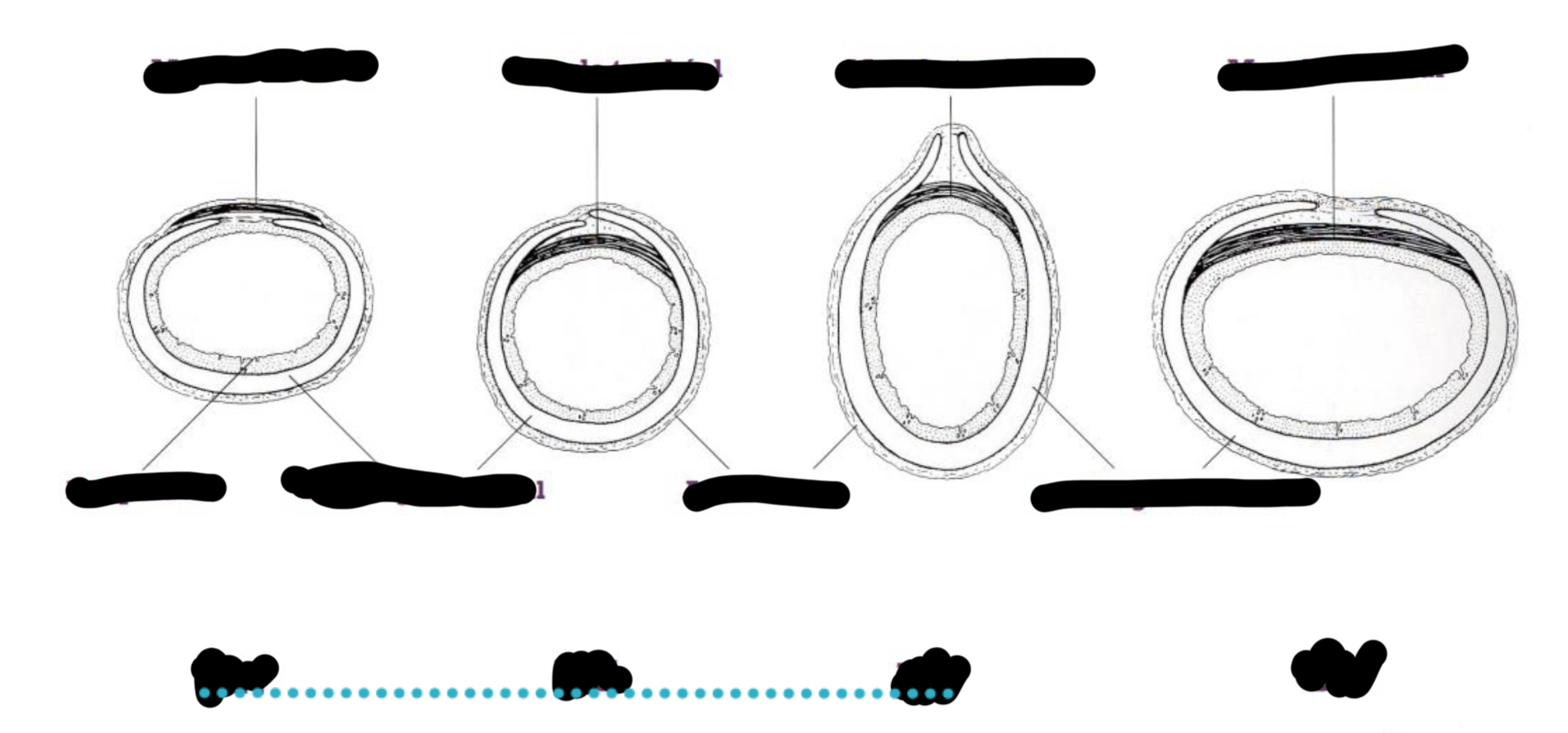 <p>Trachée def</p>