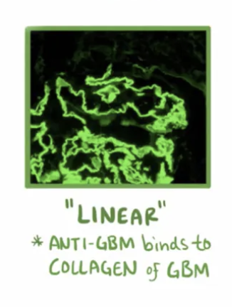 <p>Nombre de glomerulonefritis rapidamente progresiva</p>