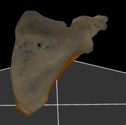 <p>de laterale rand van de scapula</p>