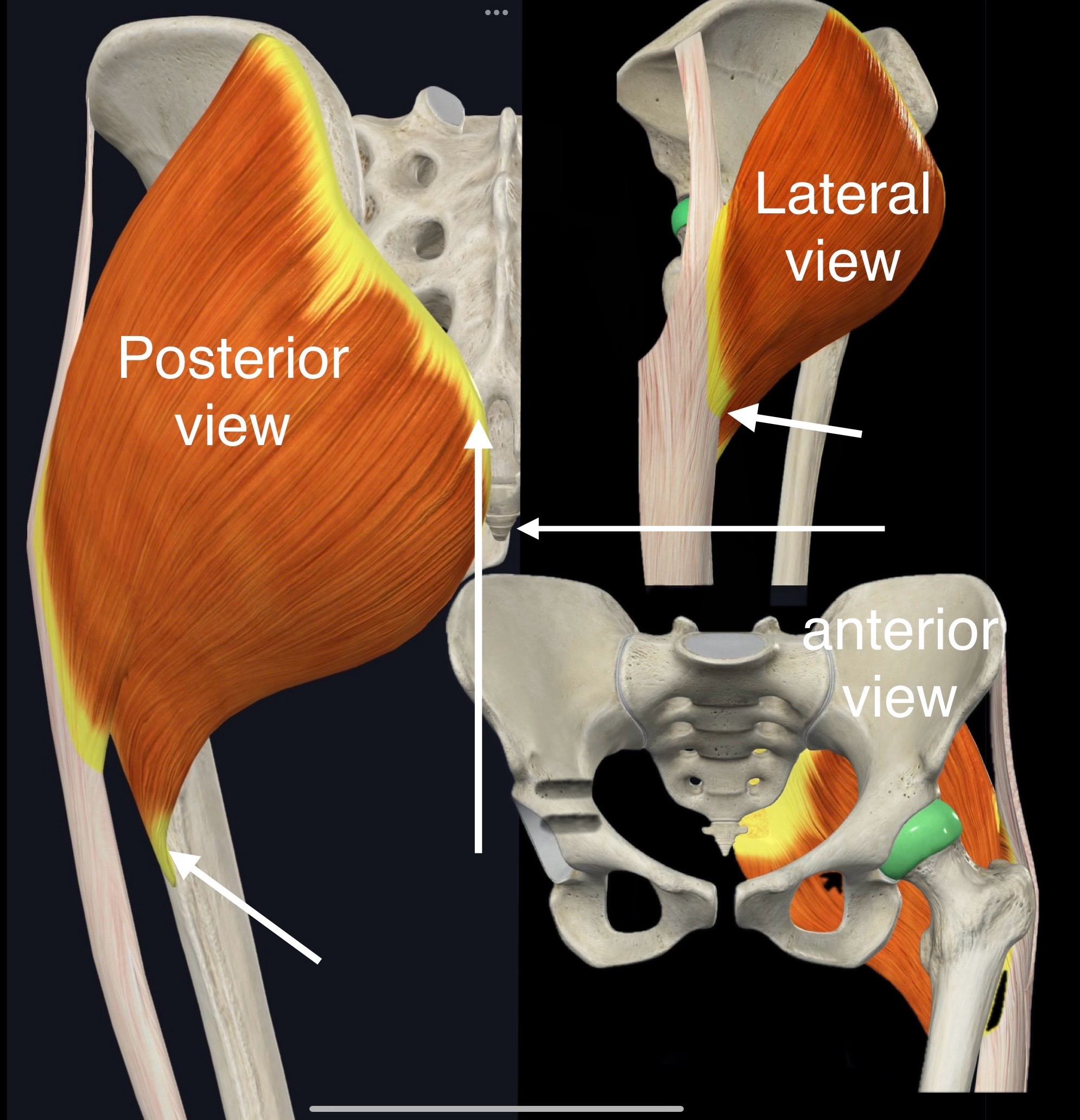 <p>Name the muscle, origin and insertion</p>