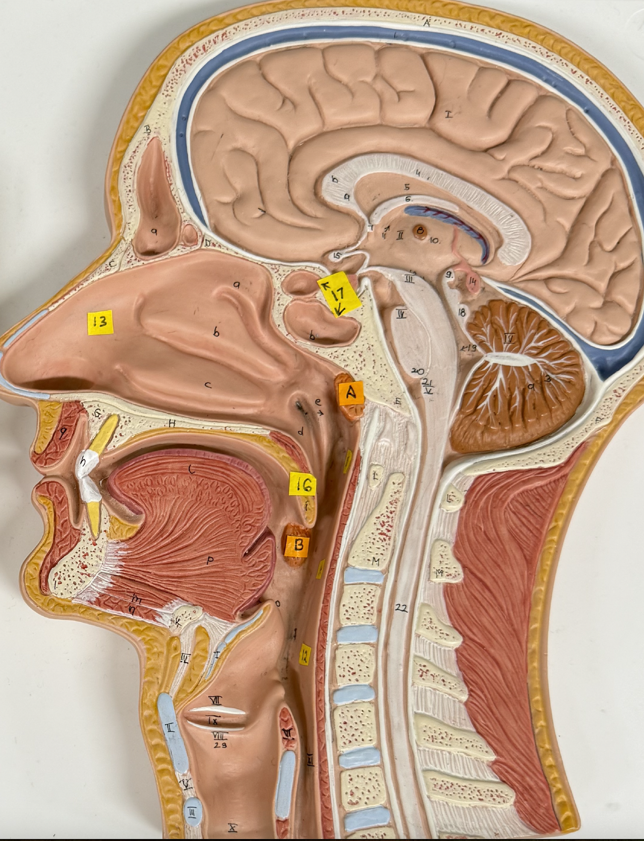 <p>Identify tonsil structures: A. B.</p>