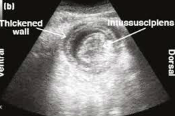 <p>surgery (resection, or reduction if viable)</p>