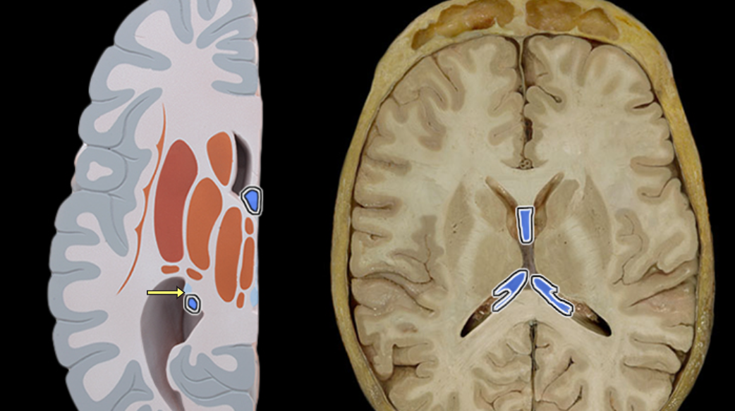 <p>Fornix of brain</p>