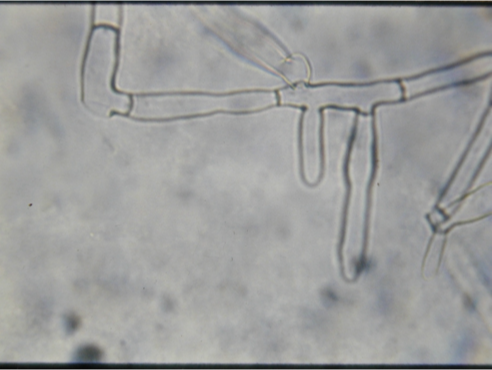 <ul><li><p>90 degree branching</p></li><li><p>No spores</p></li><li><p>Cross walls</p></li></ul><p></p>