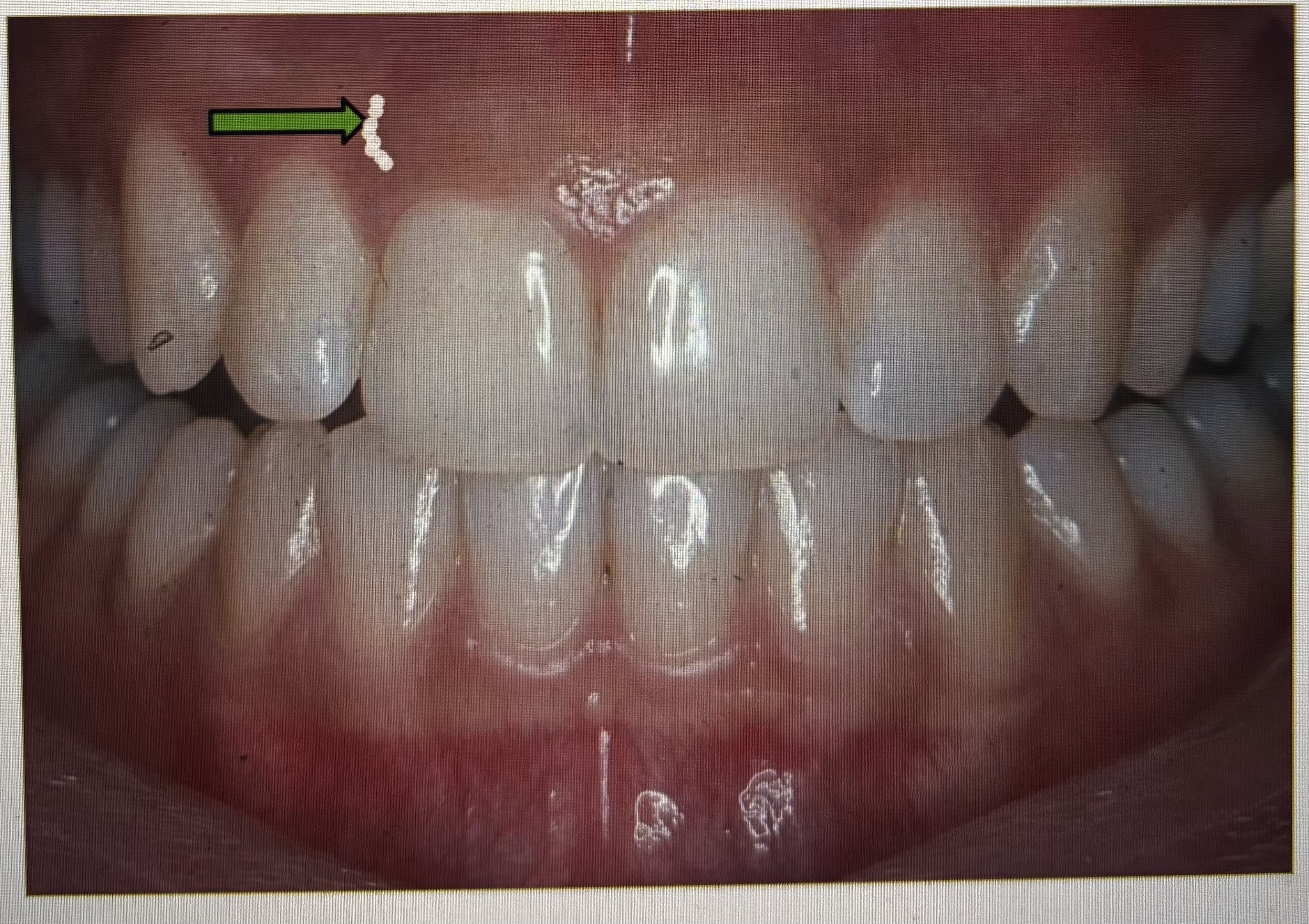 <p><span><span>Which part of the gingiva is the arrow pointing to?&nbsp;</span></span></p>