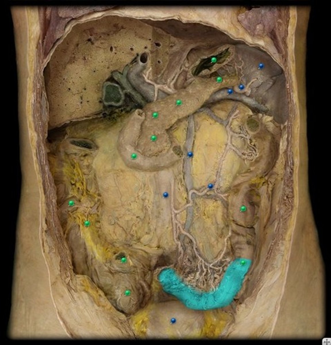 <p>The part of the large intestine that connects to the rectum.</p>
