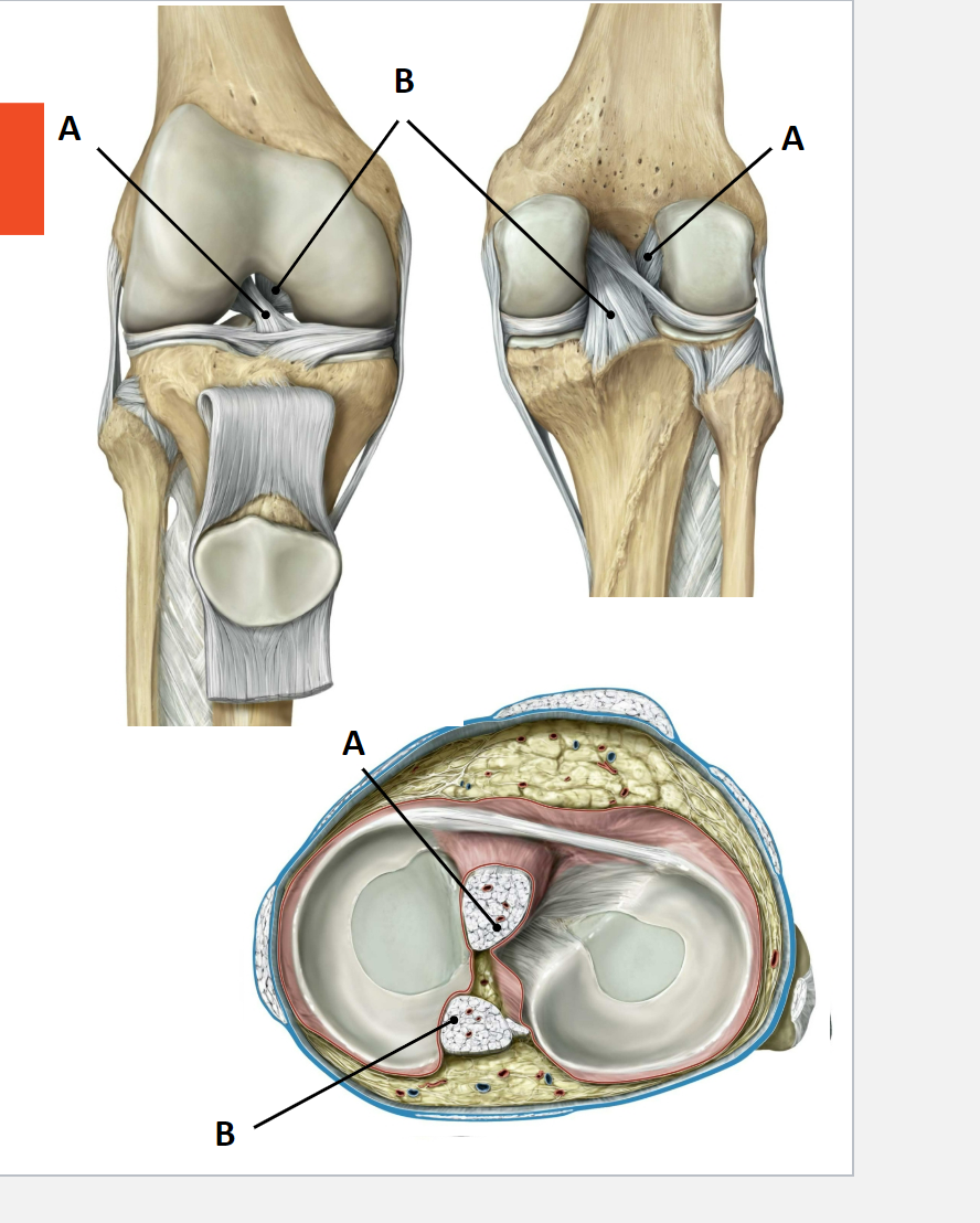 <p>The intrinsic ligaments shown are:</p><ul><li><p>anterior cruciate ligament (ACL) (lig. cruciatum anterius)</p></li><li><p>posterior cruciate ligament (PCL) (lig. cruciatum posterius)</p></li></ul><p>They are intra-capsular, extra-articular.</p><p>They connect the femur to the tibia. They play a crucial role in keeping the articular surfaces of the femur and tibia in contact, primarily stabilizing the knee joint in the sagittal plane.</p>