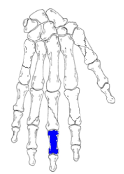 <p>What is the highlighted structure? <br>- 3rd middle phalange <br>- 2nd middle phalange <br>- 3rd distal phalange</p>