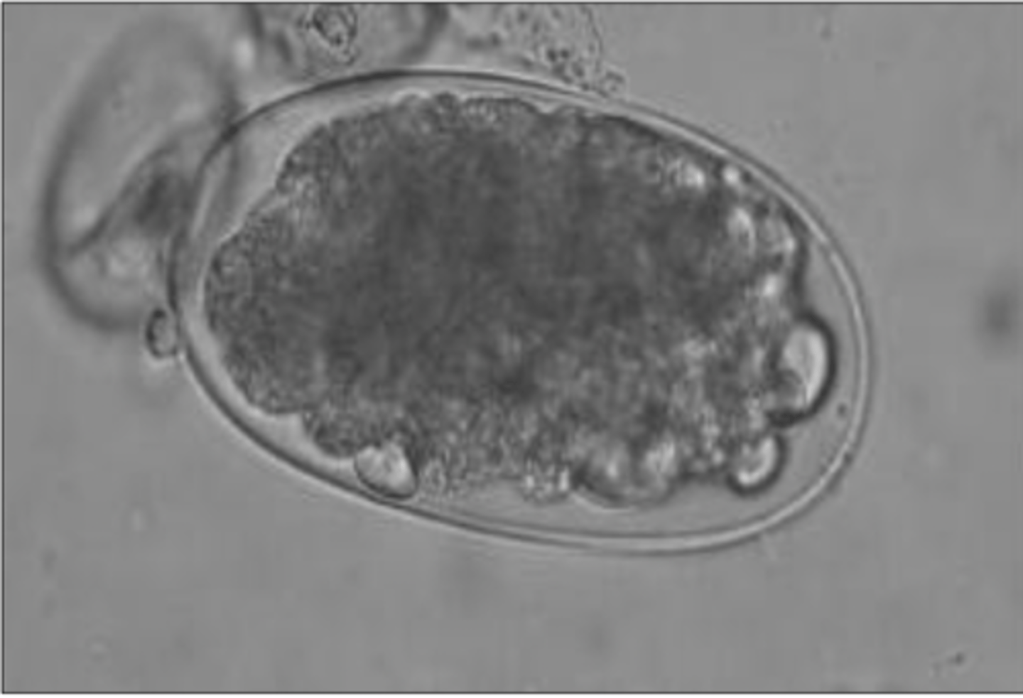 <p>What egg does this parasite belong to? It was measured to be 90 microns</p>