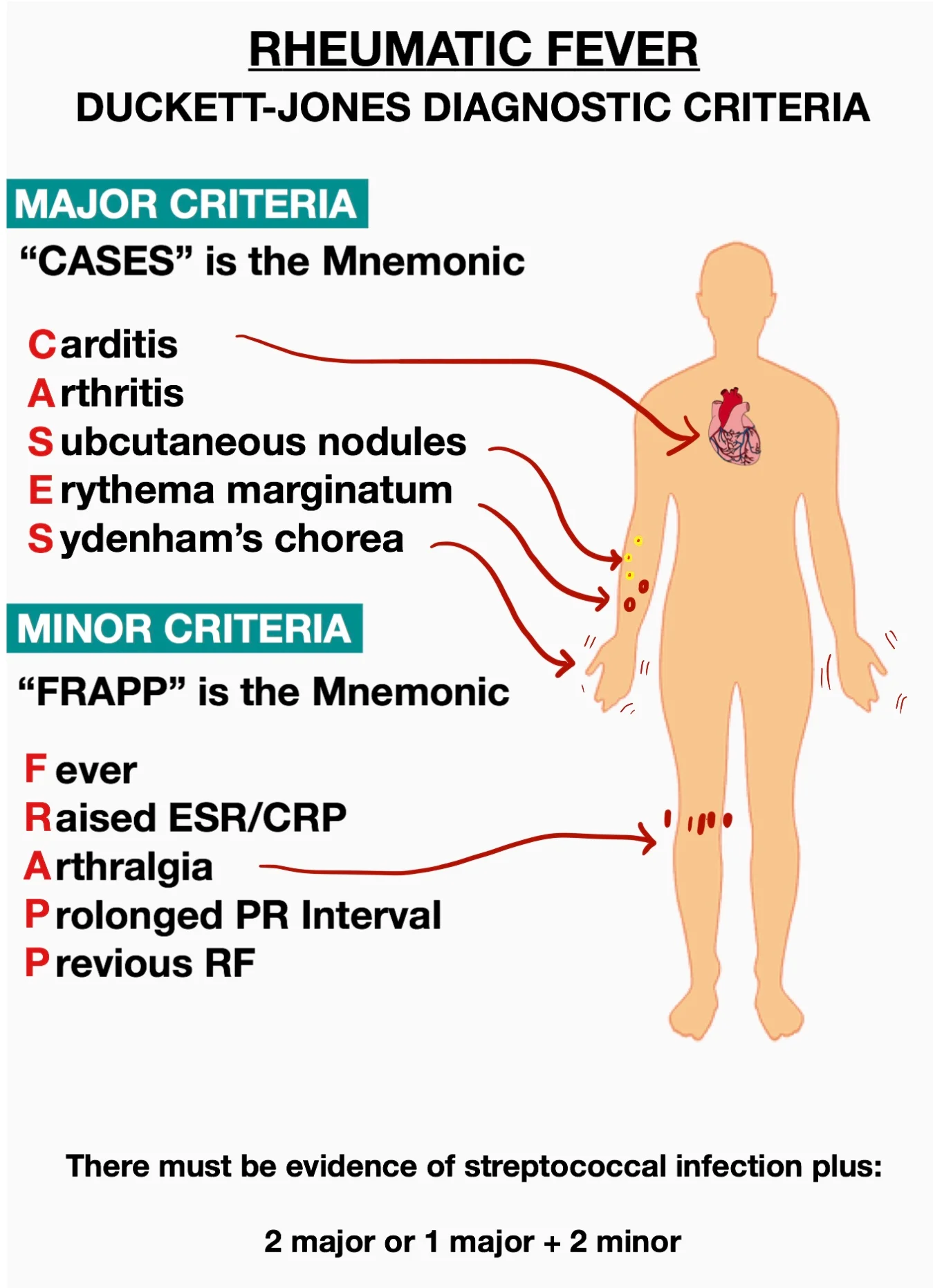 <p>2 major OR 1 major and 2 minor</p>