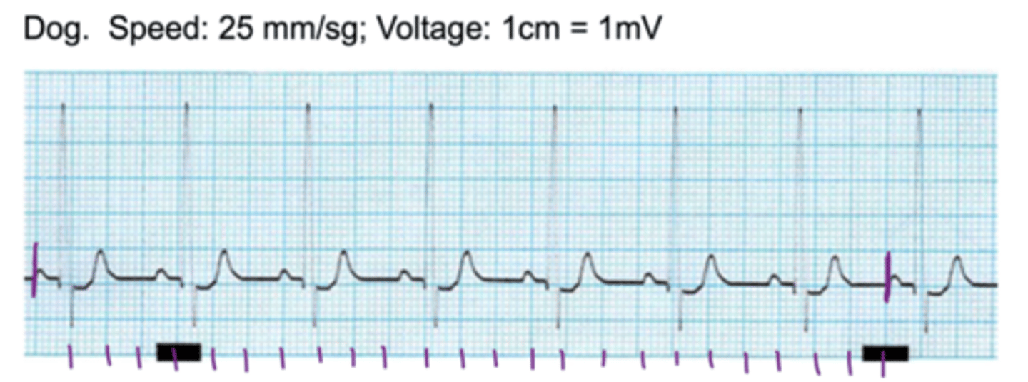 <p>what is the heart rate?</p>
