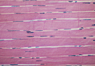 <p>Skeletal Muscle Tissue — Description</p>