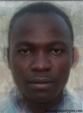 <p>Identify this Phenotype</p>