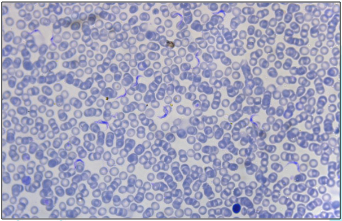 <p>A blood smear from a cow in Tanzania that is weak, emaciated, and no longer gives milk.</p><p>What sickness does Trypanosoma brucei cause in humans?</p>