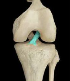 <p>ACL (anterior view)</p>