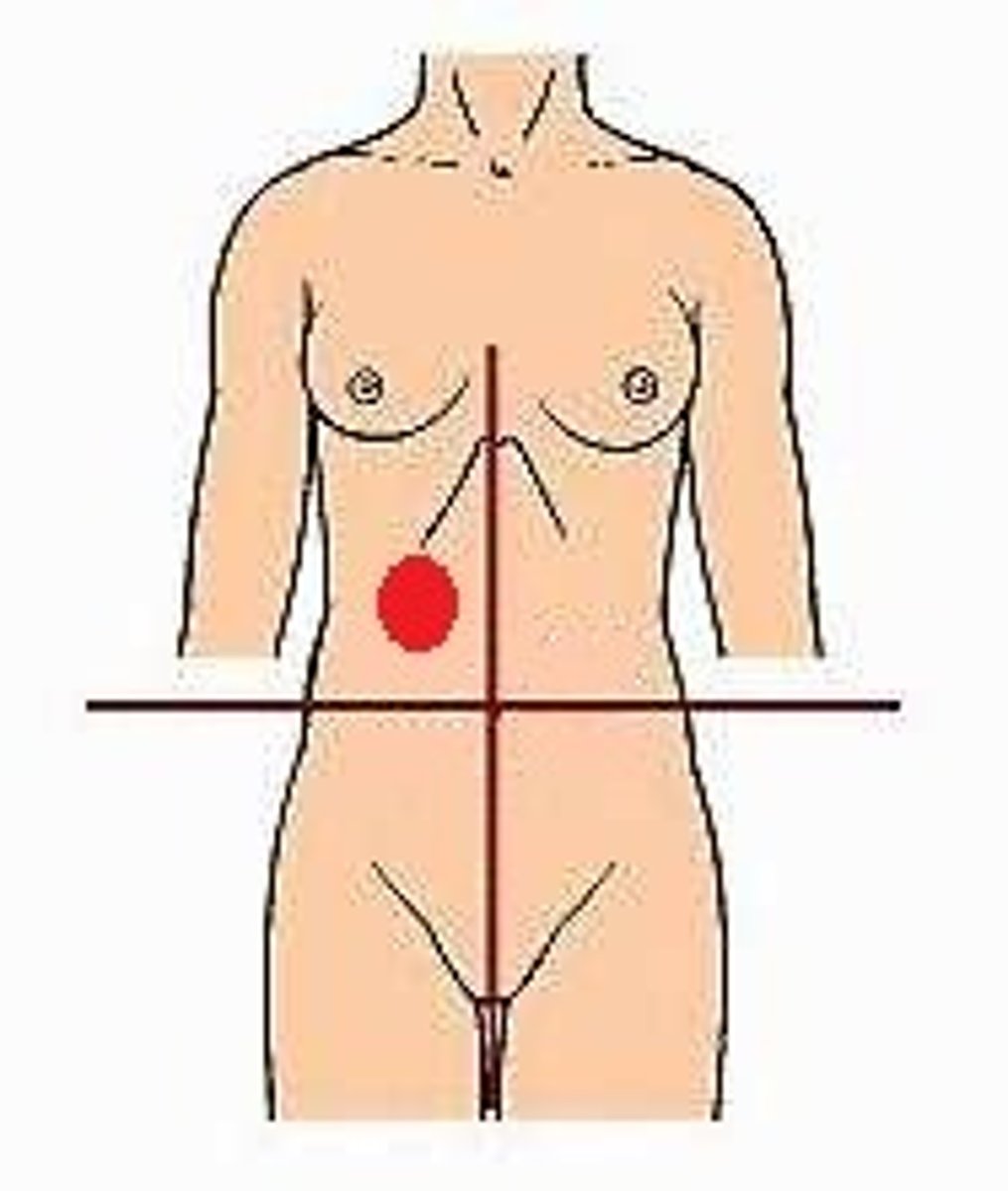 <p>Location:</p><p>Right of midline, superior to transverse plane through umbilicus</p><p>Description:</p><p>Upper right lateral area of abdominopelvic cavity</p><p>Contents include right kidney and suprarenal gland, gallbladder, and parts of liver, stomach, pancreas, and small and large intestines</p>