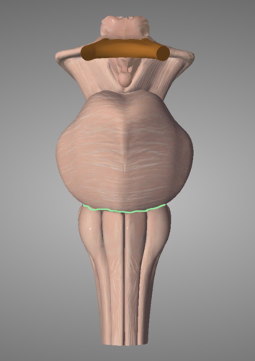 <p>Identify the groove highlighted green</p>