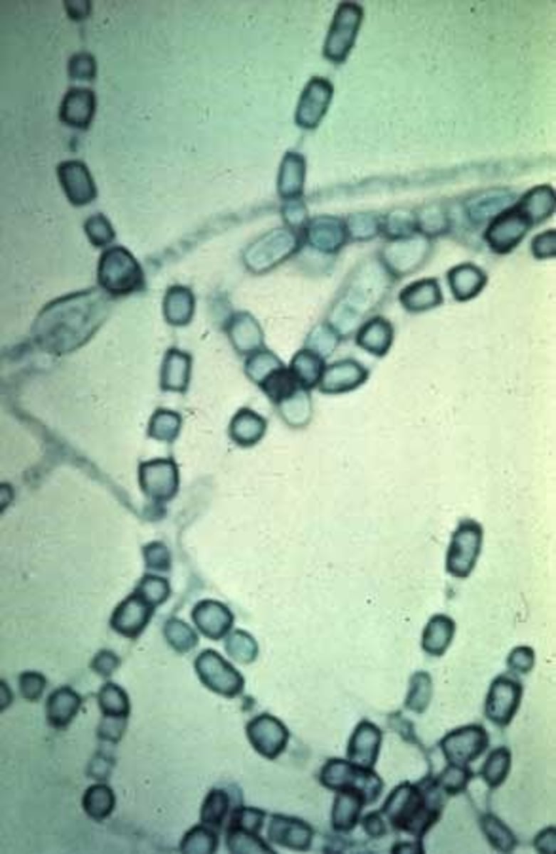 <p>Coccoidiodomycosis/ Valley fever</p><p>--hot and dry conditions increase incidence</p><p>--inhalation of conidia</p><p>--all at risk, esp elderly/immunocompromised</p>