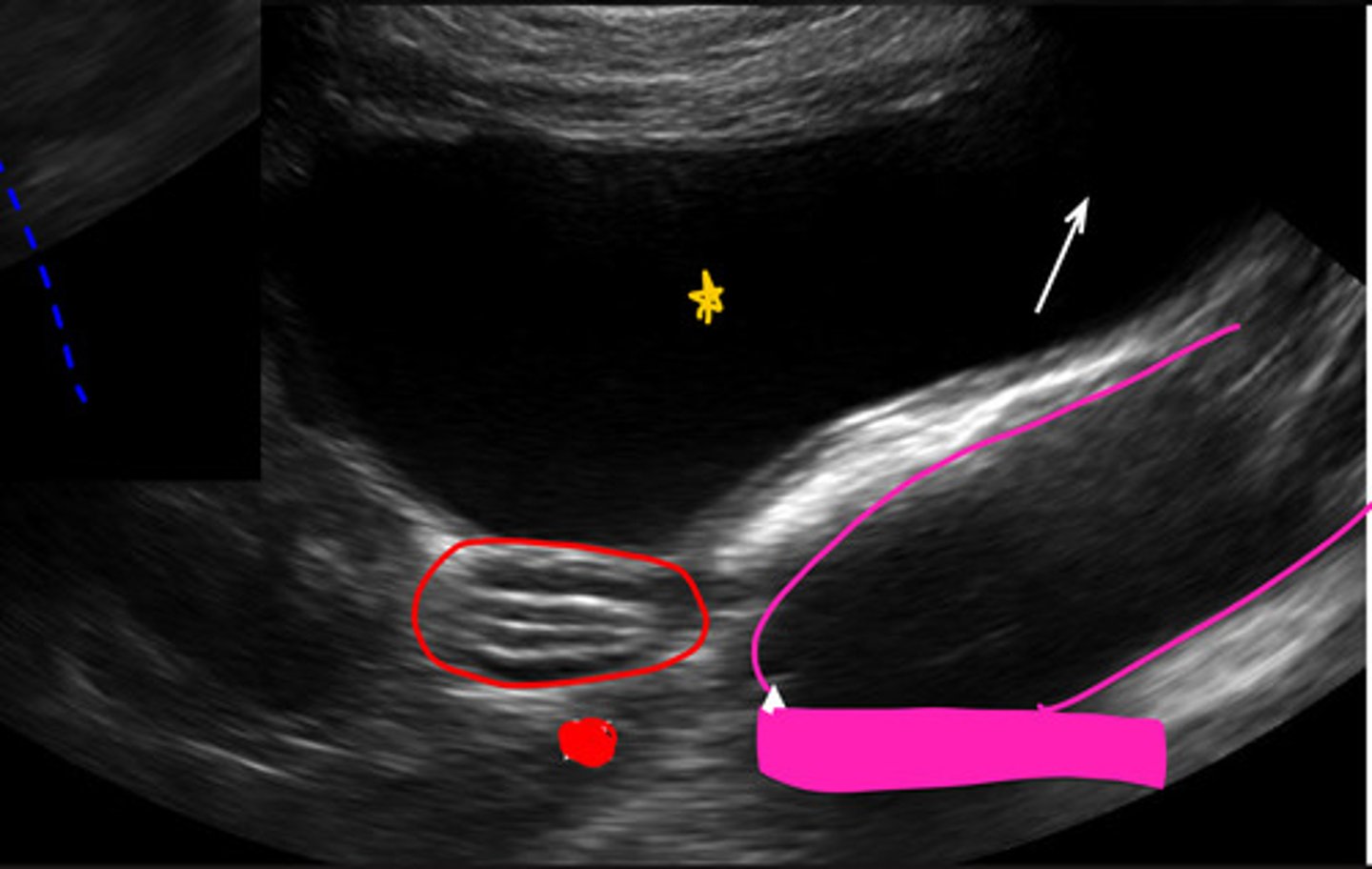 <p>ID which is bladder, SI and colon</p>