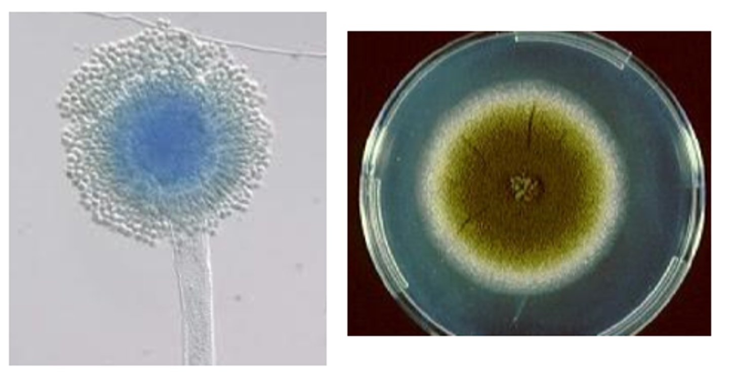 <p>· Commonly associated with aflatoxins</p><p>· Colony surface velvety, yellow to green or brown; reverse white to tan; inhibited by cycloheximide</p><p>· Conidiophores rough and spiny</p><p>· Phialides covering entire vesicle (all directions) --> afro haircut</p>