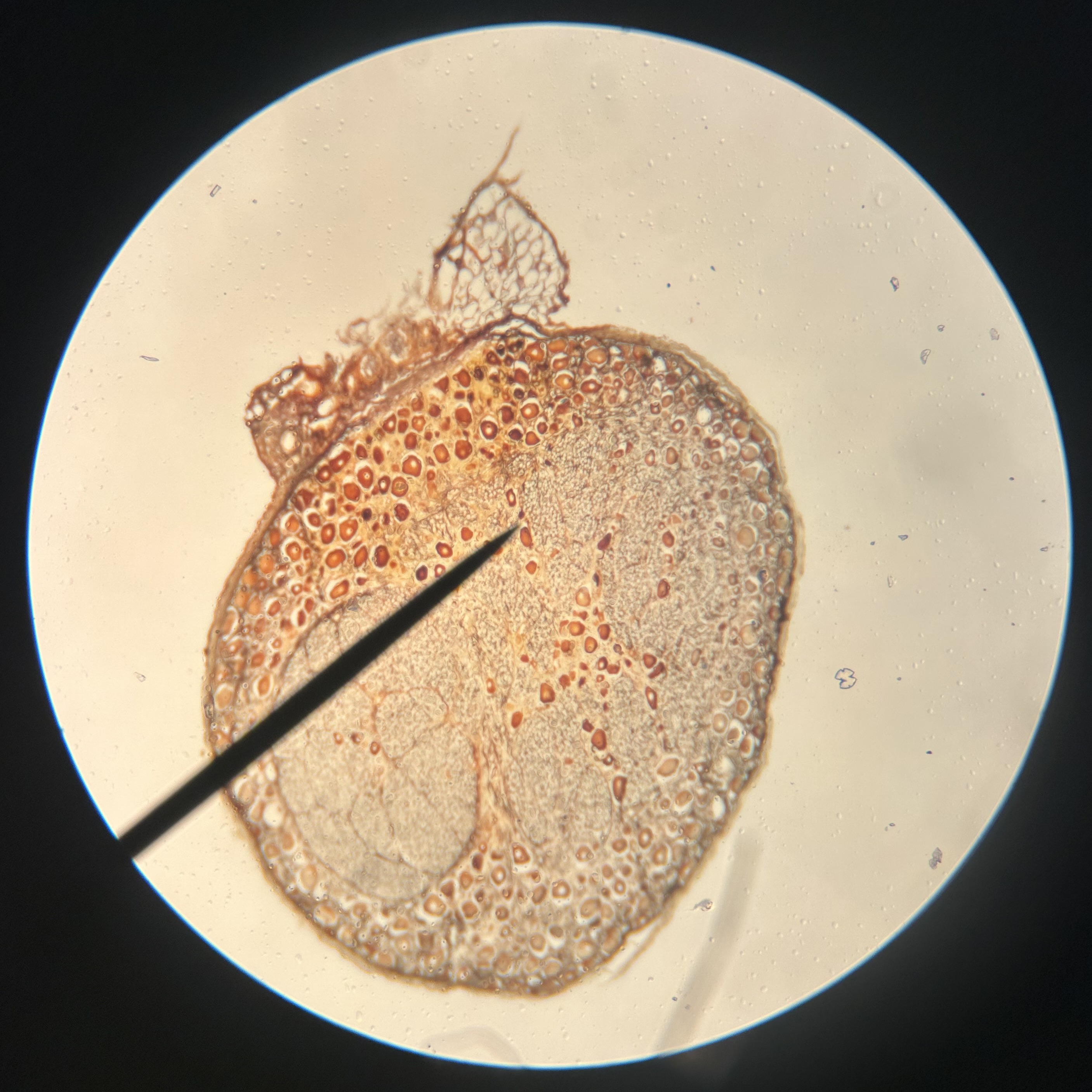 <p>What structure is shown on the pointer?</p>