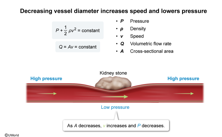 <p>Bernoulli obvo!</p><p>Also remember if A decreases, velocity increases to keep volumetric flow rate constant, now when velocity increases, pressure decreases again to keep flow rate constant</p>