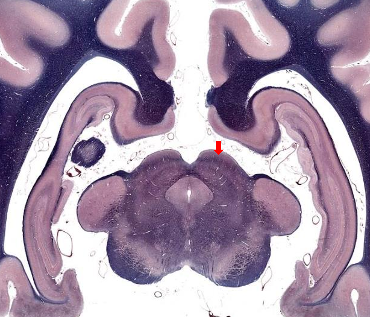 <p>26. Name the part of the canine brain indicated by the arrow.</p><p class="MsoListParagraphCxSpFirst"><span>a.</span><span style="font-size: 7pt; font-family: &quot;Times New Roman&quot;">&nbsp;&nbsp;&nbsp;&nbsp; </span>Substantia nigra</p><p class="MsoListParagraphCxSpMiddle"><span>b.</span><span style="font-size: 7pt; font-family: &quot;Times New Roman&quot;">&nbsp;&nbsp;&nbsp;&nbsp; </span>Thalamus</p><p class="MsoListParagraphCxSpMiddle"><span>c.</span><span style="font-size: 7pt; font-family: &quot;Times New Roman&quot;">&nbsp;&nbsp;&nbsp;&nbsp; </span>Pyramidal tract</p><p class="MsoListParagraphCxSpLast"><span>d.</span><span style="font-size: 7pt; font-family: &quot;Times New Roman&quot;">&nbsp;&nbsp;&nbsp;&nbsp; </span><span>Rostral colliculus</span></p>