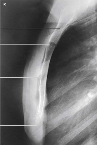 <p>What projection, position and anatomy is this?</p>